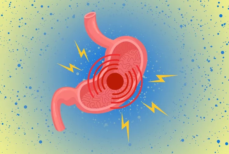 متلازمة ارتشاح الأمعاء