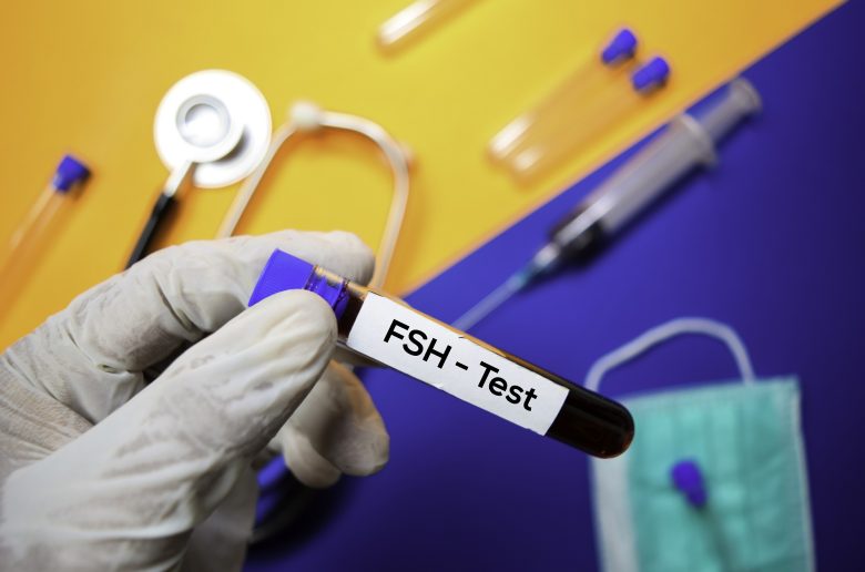هرمون FSH هرمون FSH