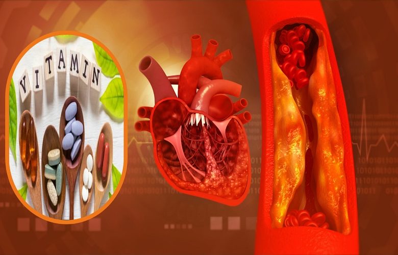 7 فيتامينات تلعب دورا فعالا في تجنب الإصابة بتصلب الشرايين 7 فيتامينات تلعب دورا فعالا في تجنب الإصابة بتصلب الشرايين