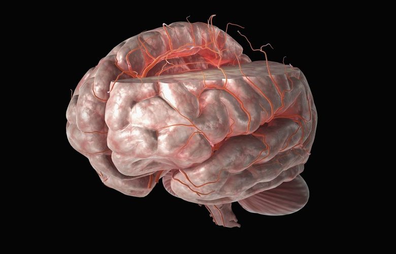 انسداد الأوعية الدموية الدماغية.. الأسباب وطرق الوقاية