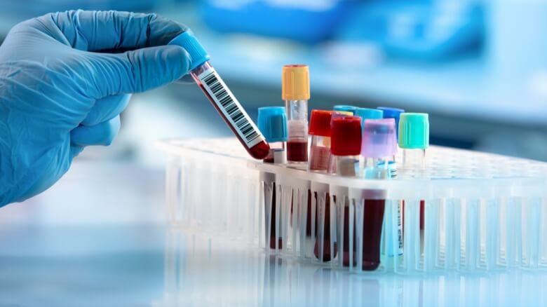 تحليل المناعة