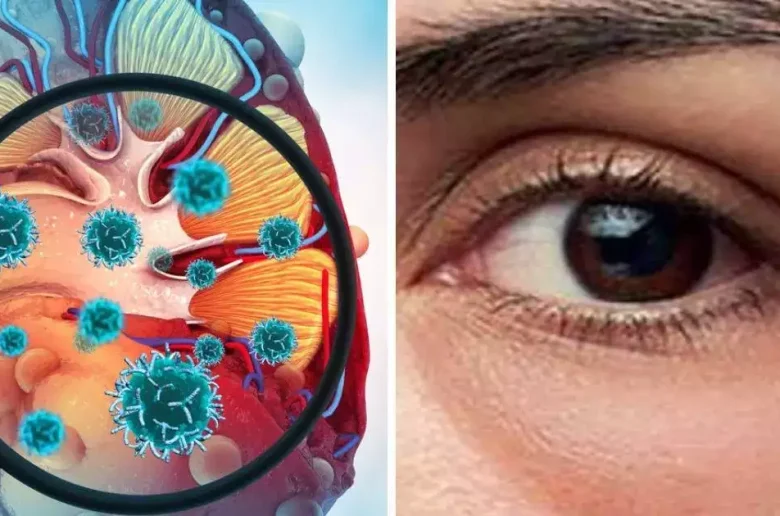علامات تحذيرية في العين تدل على معاناتك من مشكلات الكلي