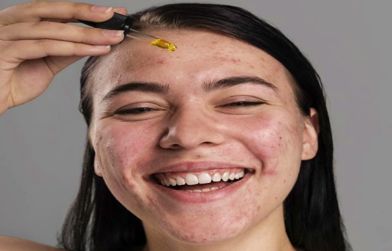 معايير هامة يجب الإلتزام بها عند اختيار السيروم للبشرة الحساسة