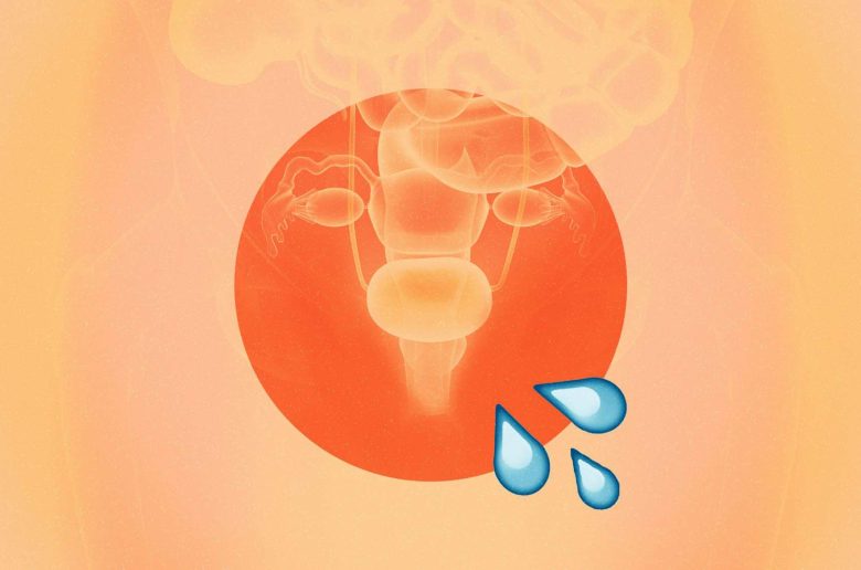 تقطير البول بعد التبول