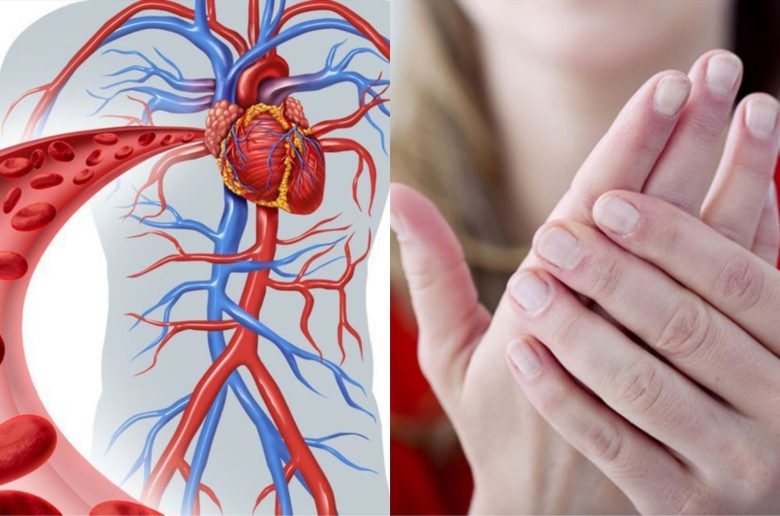 علامات ضعف الدورة الدموية علامات ضعف الدورة الدموية