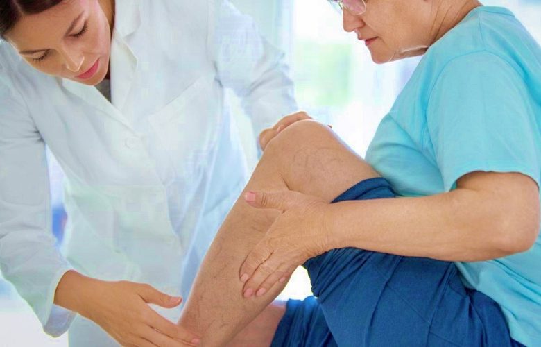  التهاب الوريد الخثاري في الساق والتعامل معه بشكل طبي