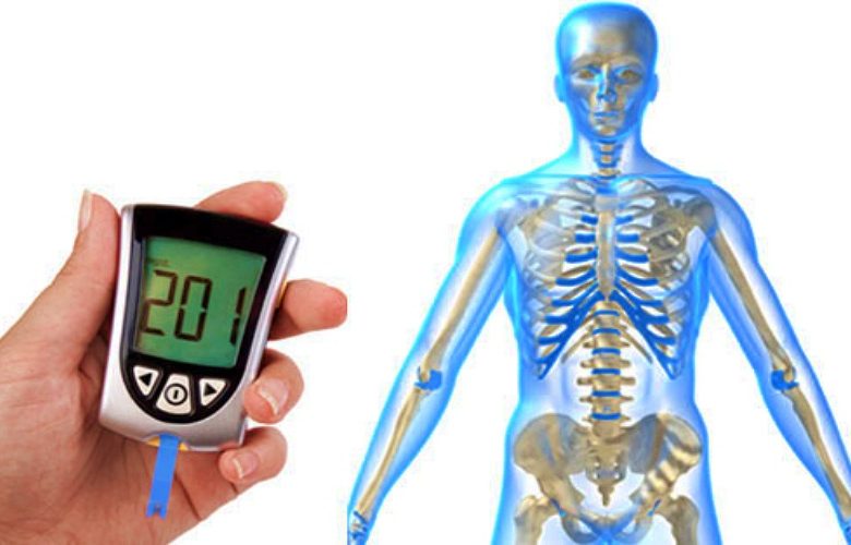 المضاعفات العضلية الهيكلية الشائعة لدى مرضى السكري