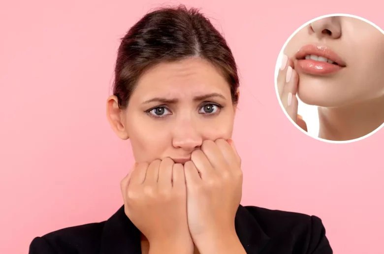 الهالات السوداء حول الشفاة