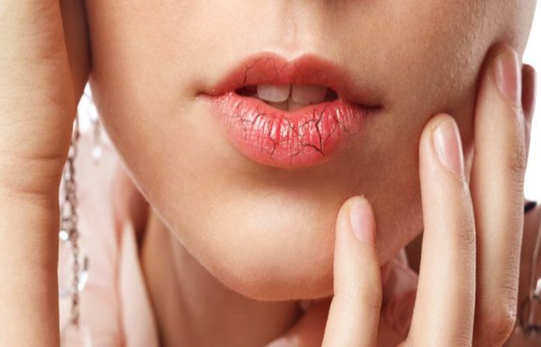 كيف نستطيع تجنب جفاف الشفاه بعد وضع أحمر الشفاه؟ كيف نستطيع تجنب جفاف الشفاه بعد وضع أحمر الشفاه؟