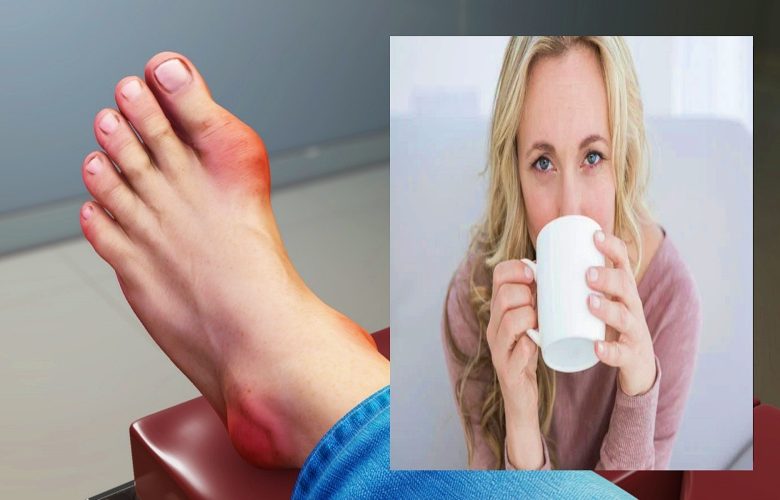 هل يساعد شرب القهوة على طرد حمض اليوريك من الجسم؟