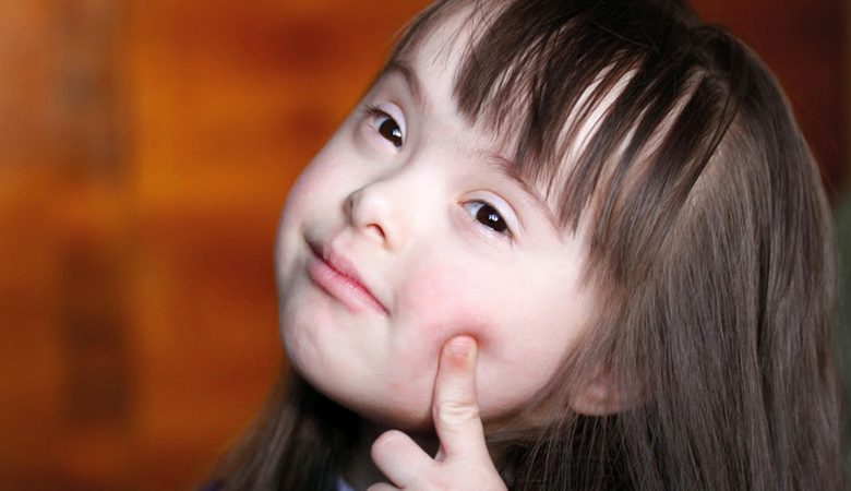 عوامل خطر تجعل الحامل أكثر عرضة لإنجاب طفل متلازمة داون