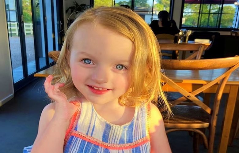 ما هي متلازمة أنجلمان (الملاك الضاحك)؟