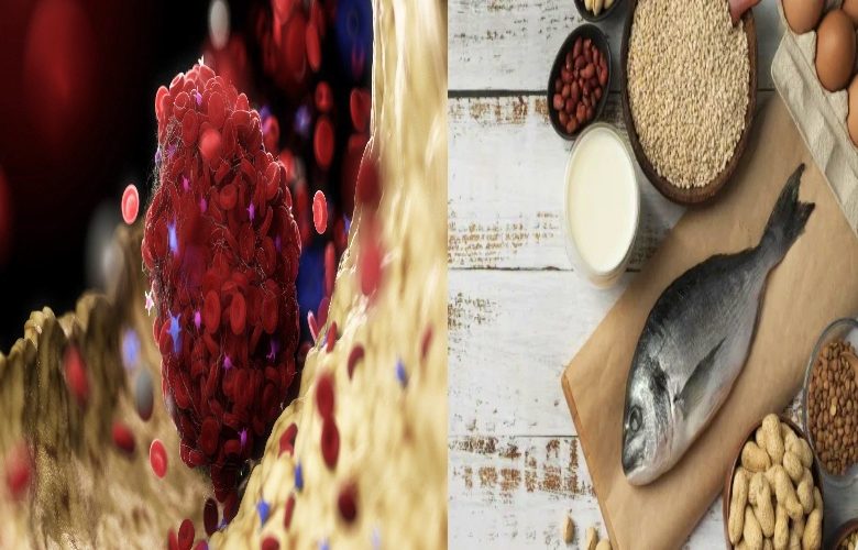 التغذية الآمنة للمرضى الذين يعانون من الجلطات الدموية