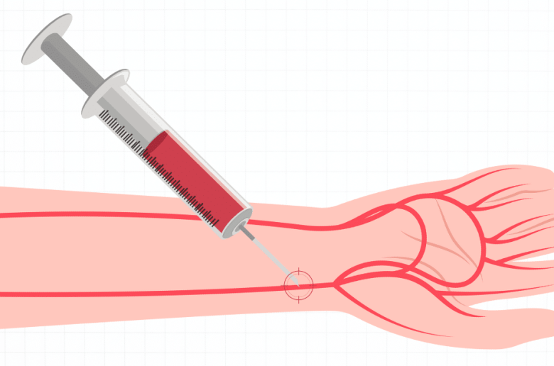 تحليل غازات الدم الشرياني