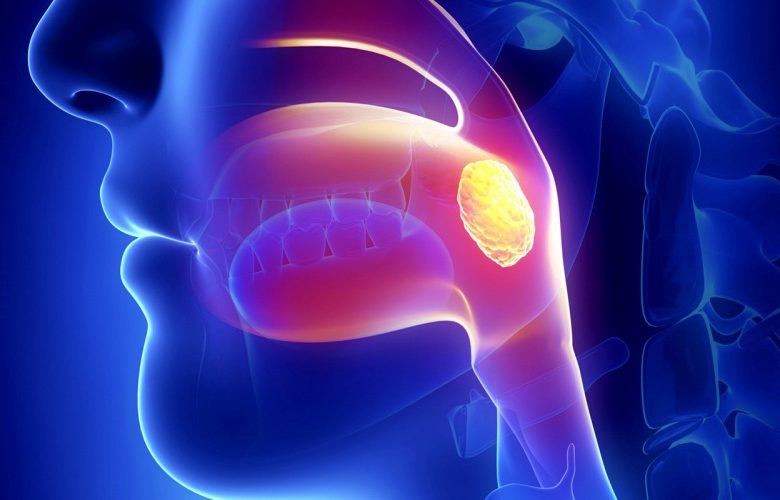 ما هي الأنماط العلاجية المعنية بالتعامل مع التهاب اللوزتين؟