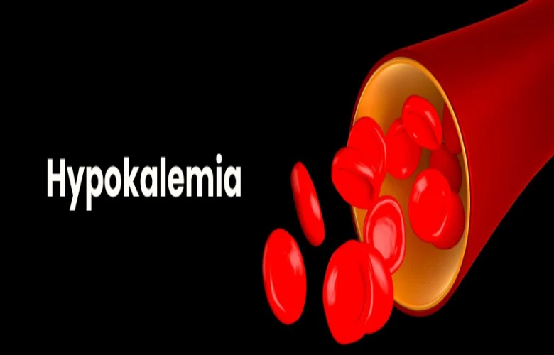 معلومات هامة تتعلق بنقص بوتاسيوم الدم داخل الجسم