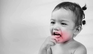 أعراض الكيس الضفدعي تحت اللسان