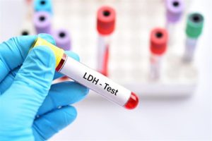 اختبار LDH