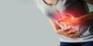 الارتجاع الحمضي