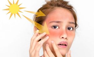 الوقاية من أضرارأشعة الشمس
