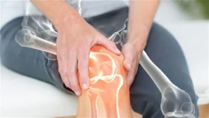 تحسين بنية العظام