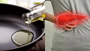 زيوت طهي صحية لمرضى الكبد الدهني