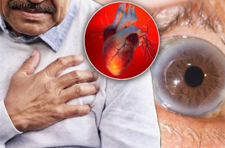 علامات غير طبيعية على العيون دالة على النوبة القلبية