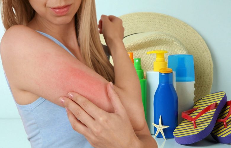 كيف يتم التعامل مع حساسية البشرة تجاه واقي الشمس؟