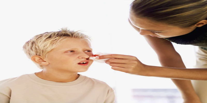 ما هي أسباب الإصابة بنزيف الأنف؟