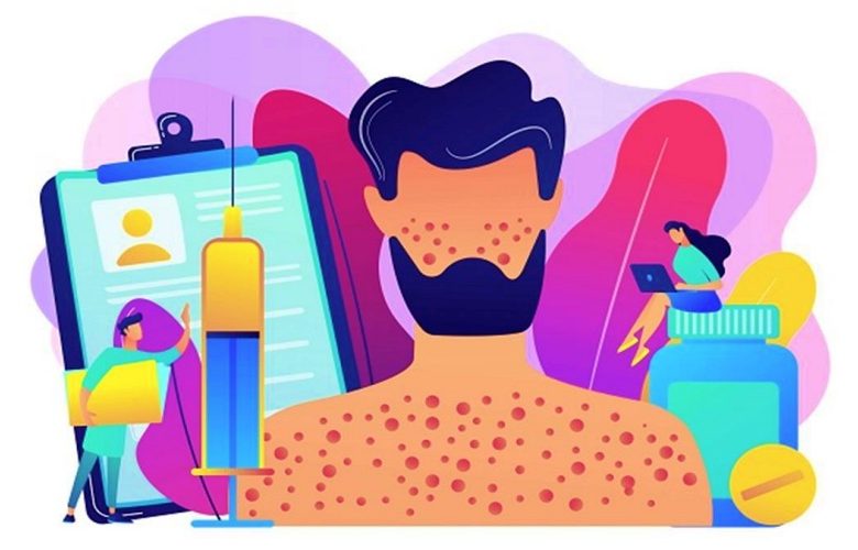 ما هي الحساسية الدوائية؟ وكيف نستطيع وقاية أنفسنا منها؟