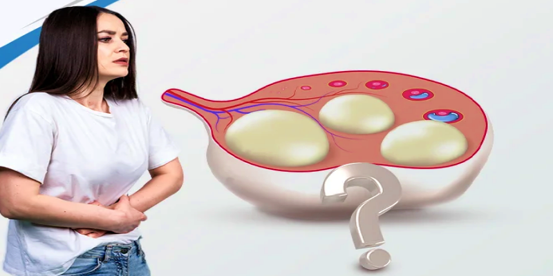ما هي العلامات النموذجية الدالة على حدوث المعاناة من تكيسات المبايض؟