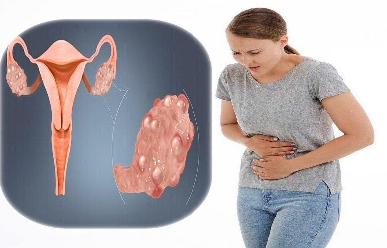 ما هي المضاعفات الصحية الخطيرة الناتجة عن تكيسات المبايض؟