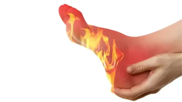 مشكلات صحية تؤدي إلى حرقان القدمين مشكلات صحية تؤدي إلى حرقان القدمين