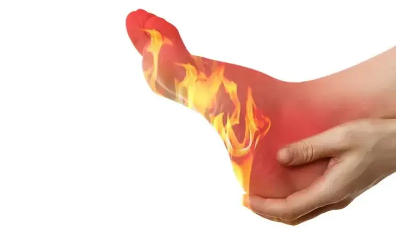 مشكلات صحية تؤدي إلى حرقان القدمين مشكلات صحية تؤدي إلى حرقان القدمين