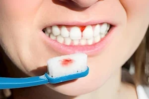 مصادر لأطعمة فعالة لإيقاف النزيف اللثوي