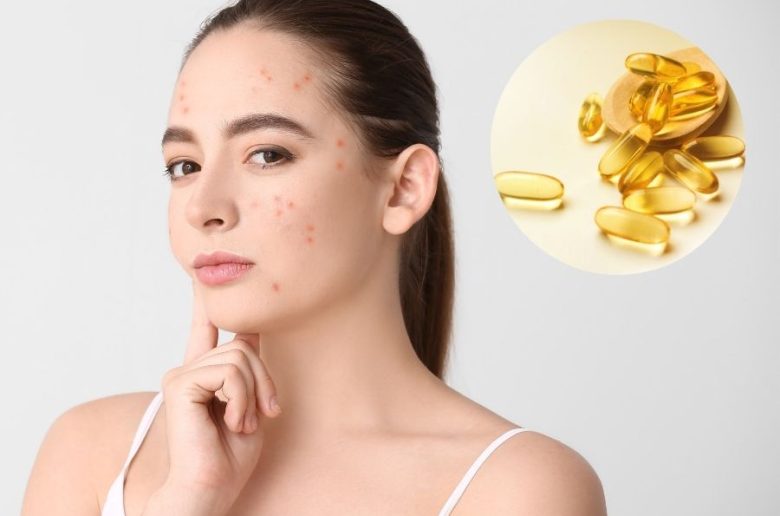 نقص مستويات أوميجا 3 على صحة البشرة