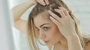وقاية فروة الرأس من العدوى