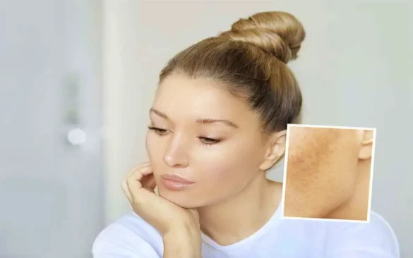 6 أخطاء تؤثر على عملية تفتيح البشرة