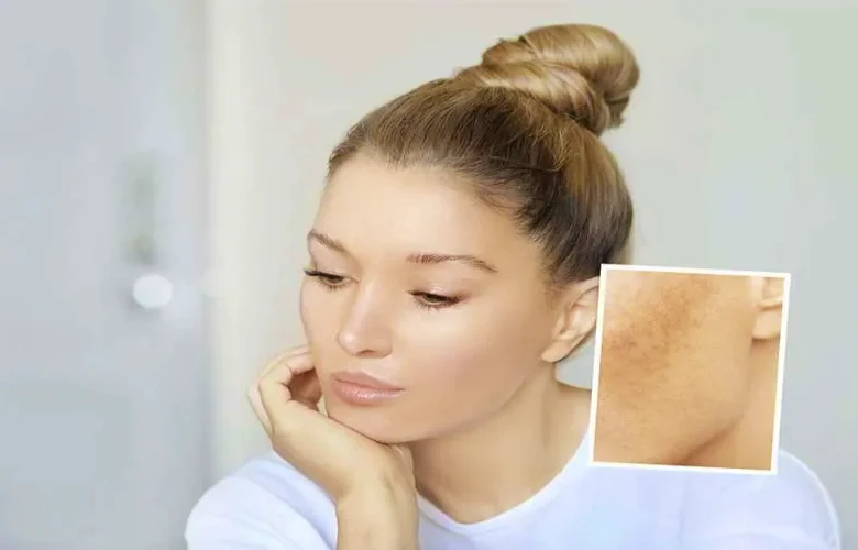 6 أخطاء تؤثر على عملية تفتيح البشرة