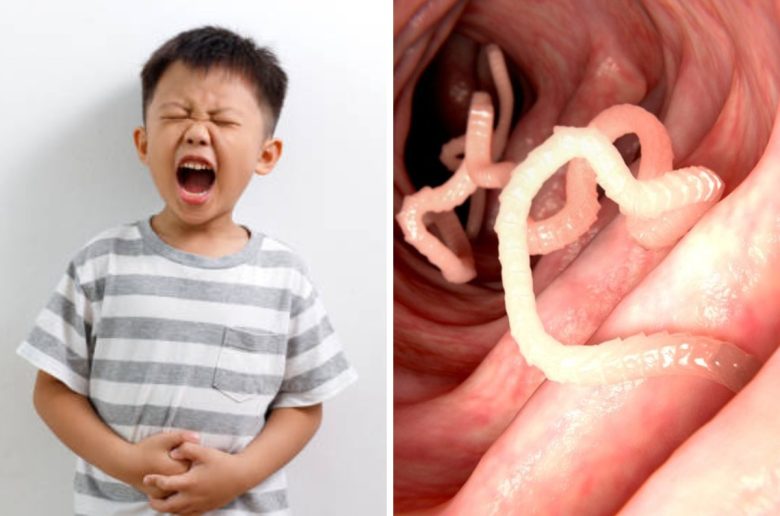 أفكار علاجية منزلية لديدان البطن عند الأطفال