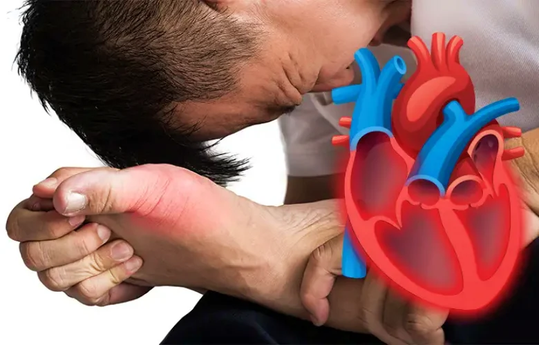 كيف يؤثر النقرس على صحة القلب والكلى؟