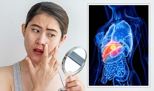 كيف يخبرك وجهك عن مشكلة في كبدك؟