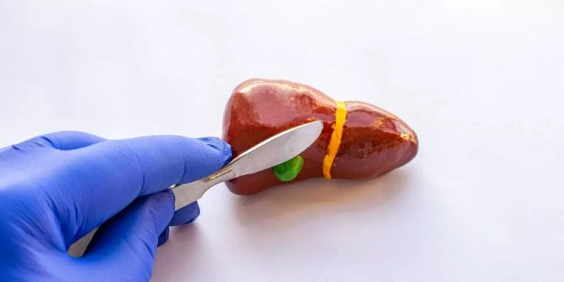 ما هي طرق علاج التهاب المرارة؟