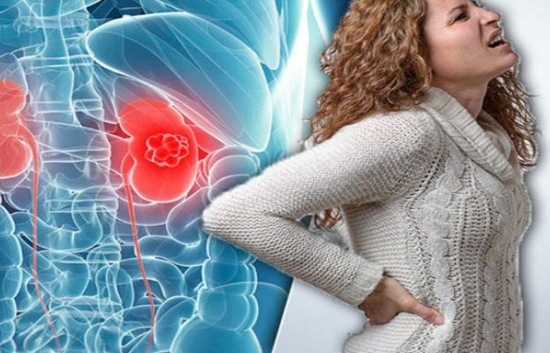 5 أخطاء شائعة يتم الوقوع فيها عند علاج أمراض الكلى المزمنة