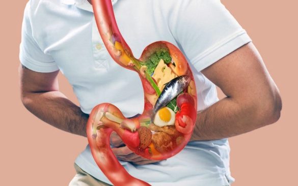 5 أطعمة يمكن أن تساعد في الوقاية من الإصابة بسرطان المعدة