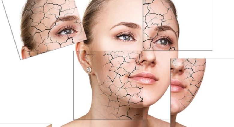 عادات خاطئة تؤدي إلى بشرة شديدة الجفاف في فصل الصيف