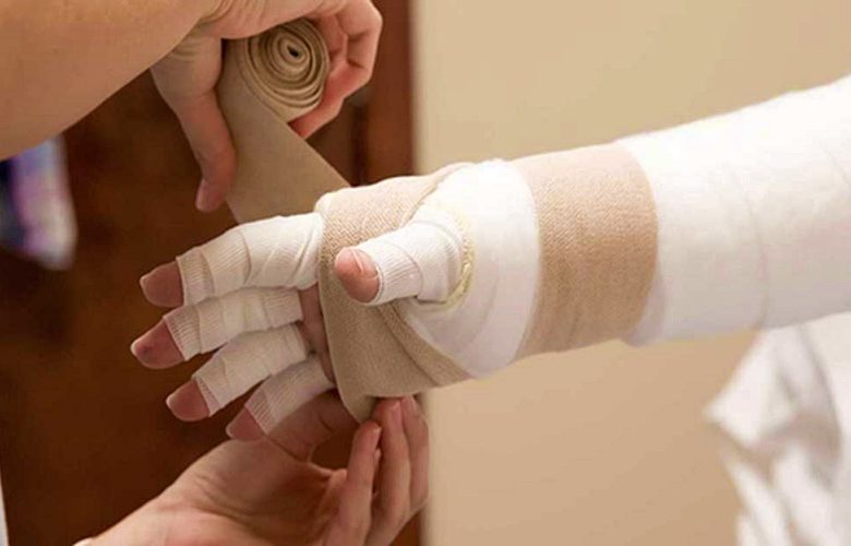 كيف نتعامل مع الوذمة اللمفية التي تصيب مرضى سرطان الثدي؟