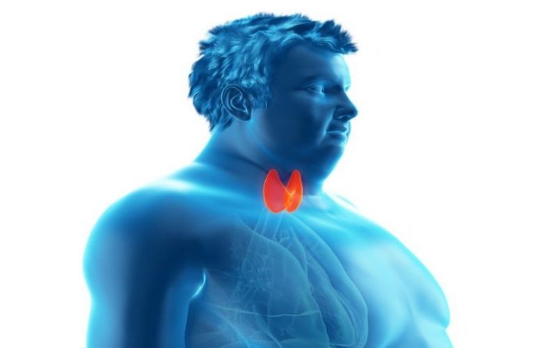 لماذا تسبب اضطرابات الغدد الصماء زيادة الوزن والسمنة؟ لماذا تسبب اضطرابات الغدد الصماء زيادة الوزن والسمنة؟