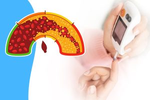مكملات غذائية ضرورية لمرضى مقاومة الأنسولين
