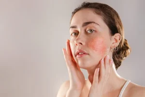 مهدىء طبيعي للبشرة الحساسة